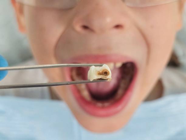 Best Tooth Pain Emergency Relief  in Ashland, VA